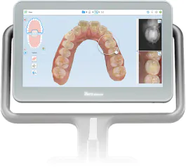 高精度口腔内3Dスキャナー
