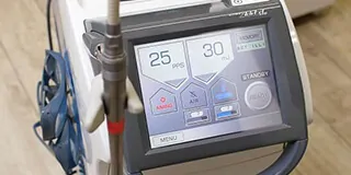 Er:YAG(エルビウム・ヤグ)レーザー