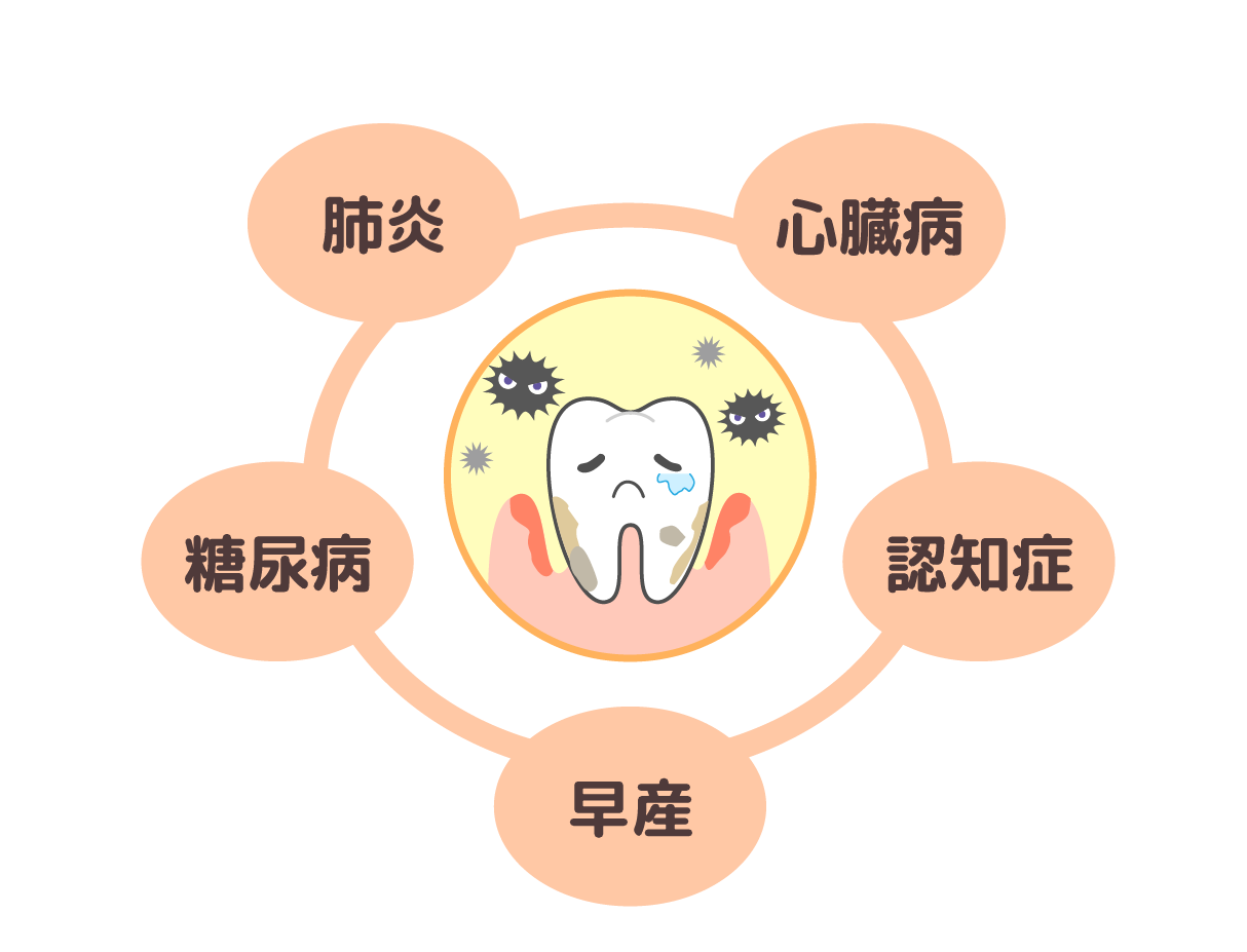 歯周病との関連性が指摘されている主な疾患