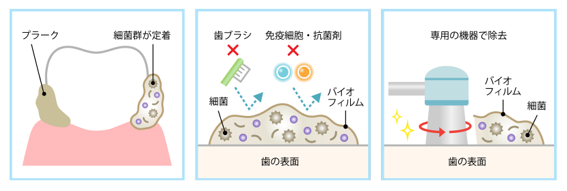 バイオフィルムのイメージ