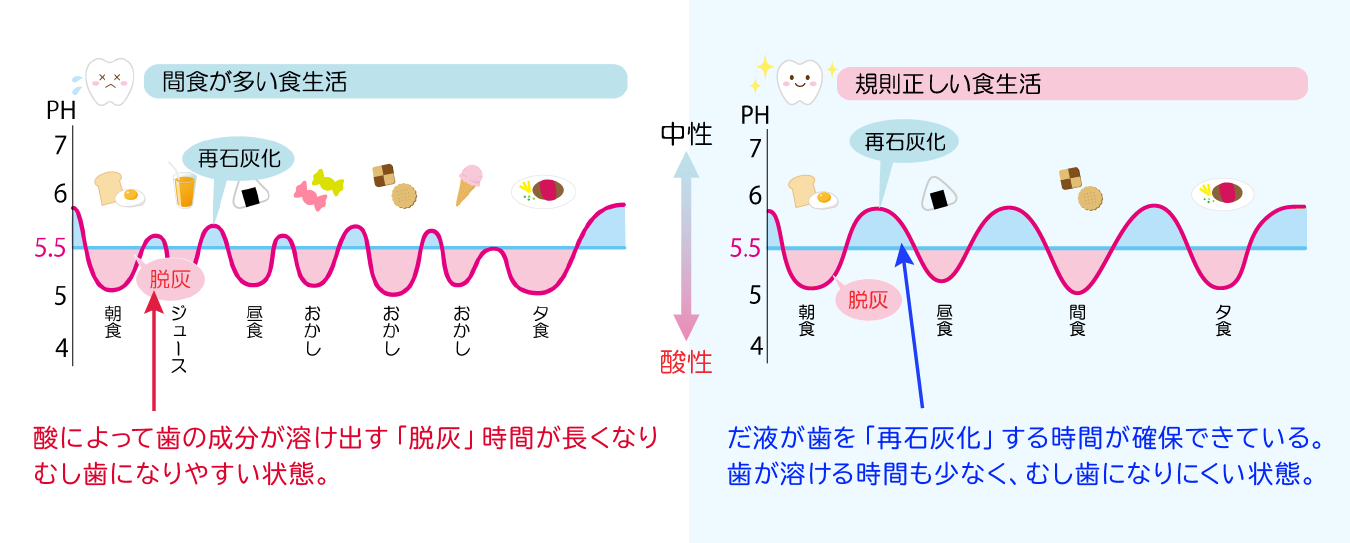 食習慣の違いによる脱灰・再石灰化のイメージ